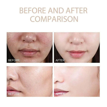Reveal Your Radiance and Embrace Confident Beauty